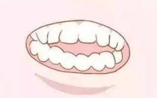 矫正牙齿的危害有哪些